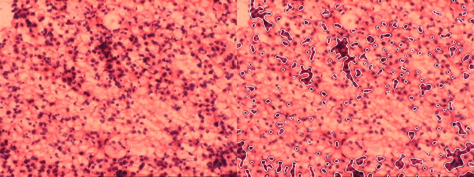 Analiza komórek nowotworowych - zdjęcie