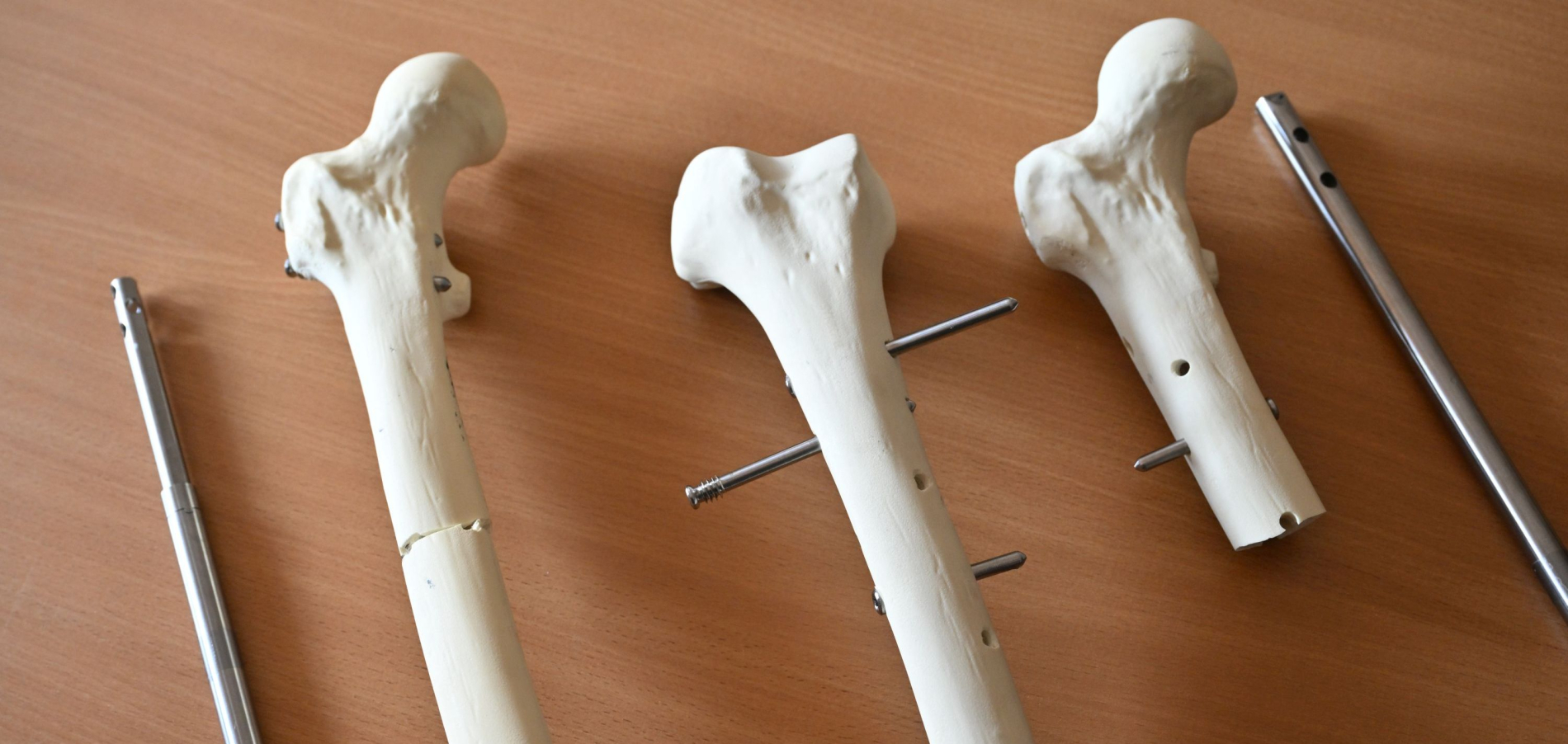 kosci_implant_plaskie2025.jpg